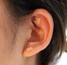 Ear Acupressure 